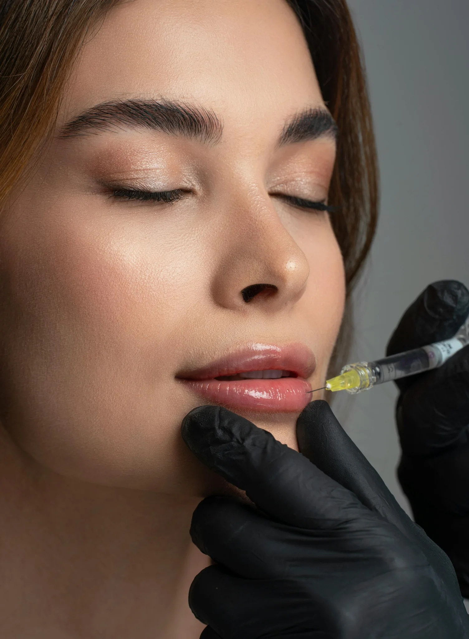 Preenchimento labial com contorno e naturalidade