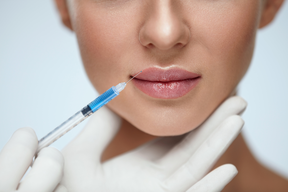 Preenchimento labial com avaliação facial
