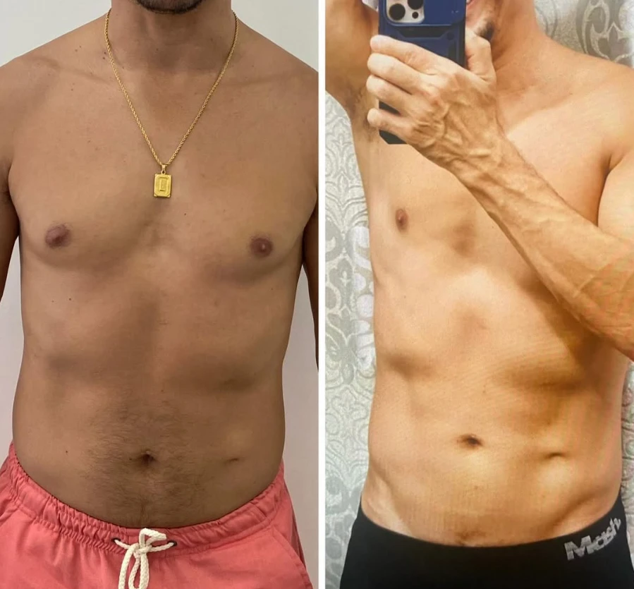 Antes e depois corporal masculino WR